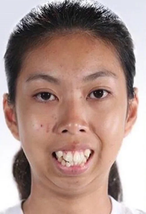 gái xấu 58