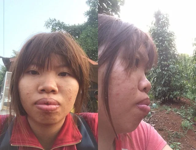 gái xấu 40