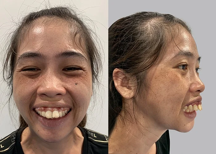 gái xấu 65