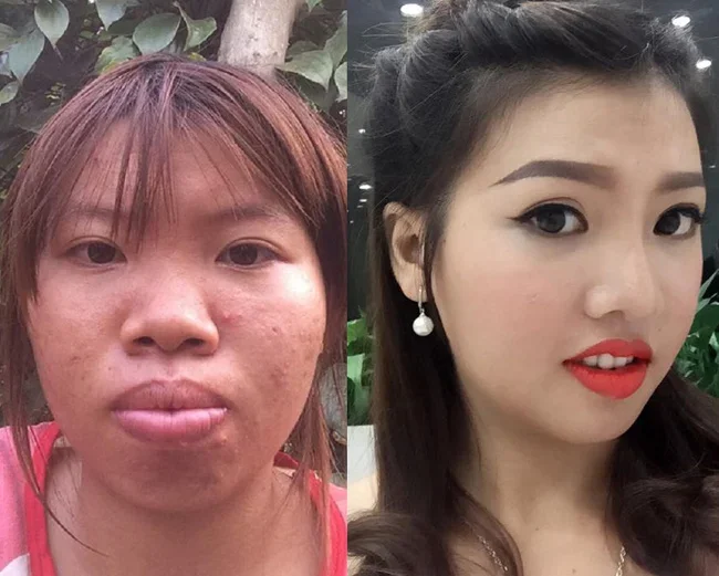 8 ca thẩm mỹ biến gái xấu thành tiên